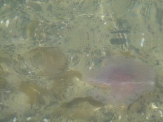 stinging jellyfish in water